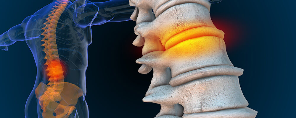 What Spine Vertebrae Correspond to Different Areas of Pain?