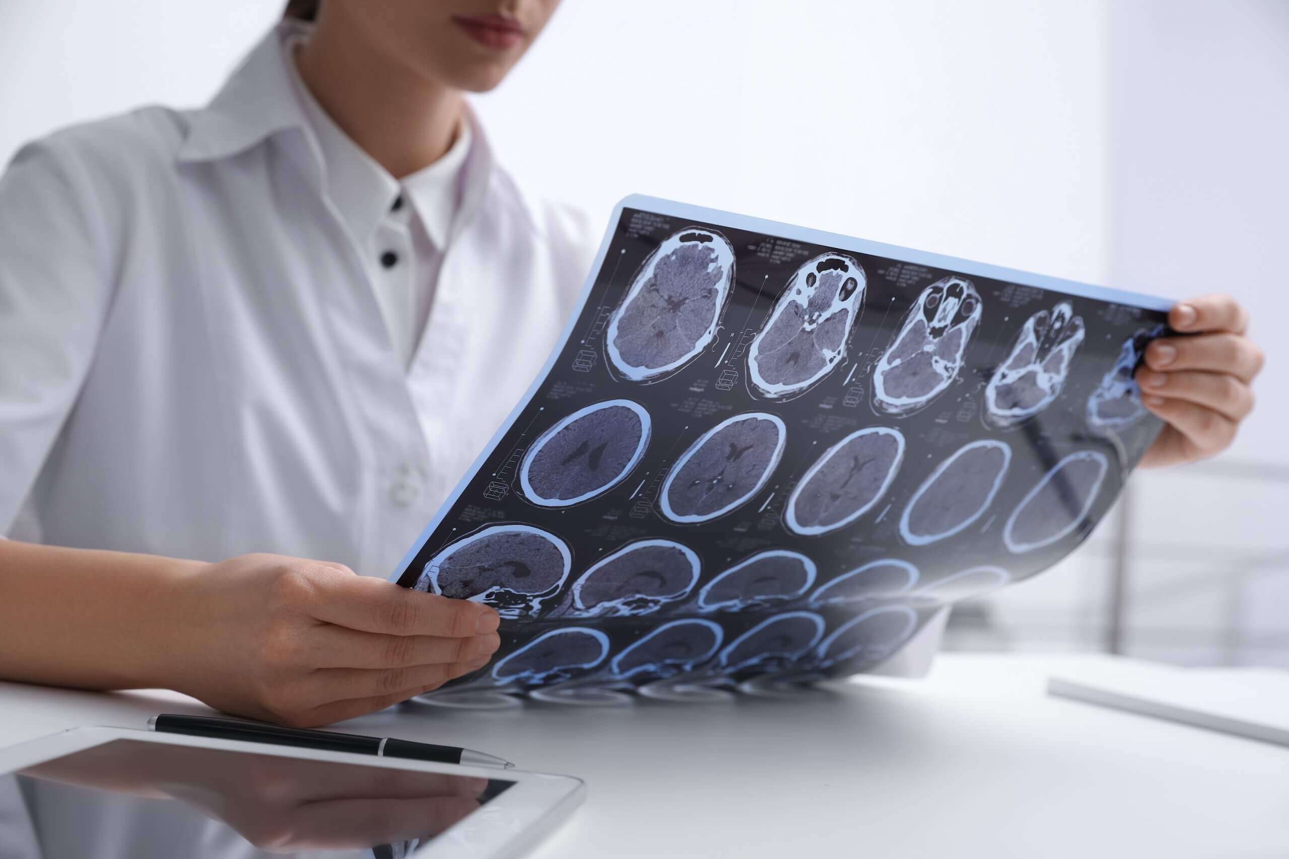 Multiple Sclerosis vs. Atherosclerosis: What’s the Difference and Is There a Connection?